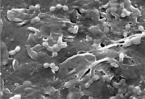 Image 1: Scanning electron microscopy image of E. coli O157:H7 cells attached to ­plastic material.